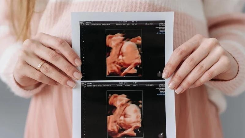 سونوگرافی رنگی برای بارداری خطرناک است؟